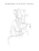 METHODS AND SYSTEMS FOR IMPROVING AIRWAY PATENCY diagram and image