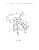 METHODS AND SYSTEMS FOR IMPROVING AIRWAY PATENCY diagram and image