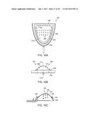 METHODS AND SYSTEMS FOR IMPROVING AIRWAY PATENCY diagram and image