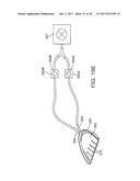 METHODS AND SYSTEMS FOR IMPROVING AIRWAY PATENCY diagram and image