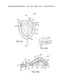 METHODS AND SYSTEMS FOR IMPROVING AIRWAY PATENCY diagram and image