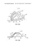 METHODS AND SYSTEMS FOR IMPROVING AIRWAY PATENCY diagram and image