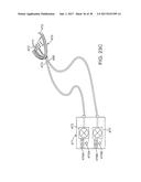 METHODS AND SYSTEMS FOR IMPROVING AIRWAY PATENCY diagram and image