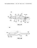 ULTRASONIC SURGICAL APPARATUS WITH SILICON WAVEGUIDE diagram and image