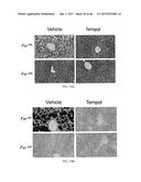 INHIBITORS OF THE FARNESOID X RECEPTOR AND USES IN MEDICINE diagram and image