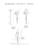 DEVICES, SYSTEMS, AND METHODS FOR PERFORMING ENDOSCOPIC SURGICAL     PROCEDURES diagram and image