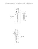 DEVICES, SYSTEMS, AND METHODS FOR PERFORMING ENDOSCOPIC SURGICAL     PROCEDURES diagram and image