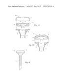 DEVICES, SYSTEMS, AND METHODS FOR PERFORMING ENDOSCOPIC SURGICAL     PROCEDURES diagram and image