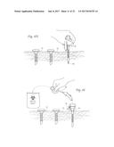 DEVICES, SYSTEMS, AND METHODS FOR PERFORMING ENDOSCOPIC SURGICAL     PROCEDURES diagram and image