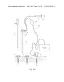 DEVICES, SYSTEMS, AND METHODS FOR PERFORMING ENDOSCOPIC SURGICAL     PROCEDURES diagram and image