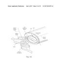 DEVICES, SYSTEMS, AND METHODS FOR PERFORMING ENDOSCOPIC SURGICAL     PROCEDURES diagram and image