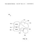 BONE PLATES CONFIGURED TO RIGIDLY FIX FRAGMENTS OF A BONE TO ONE ANOTHER diagram and image