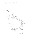 BONE PLATES CONFIGURED TO RIGIDLY FIX FRAGMENTS OF A BONE TO ONE ANOTHER diagram and image