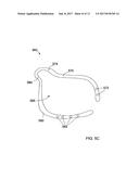 BONE PLATES CONFIGURED TO RIGIDLY FIX FRAGMENTS OF A BONE TO ONE ANOTHER diagram and image