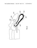 BONE PLATES CONFIGURED TO RIGIDLY FIX FRAGMENTS OF A BONE TO ONE ANOTHER diagram and image