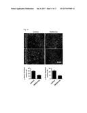 COMPOSITION USING METFORMIN FOR PREVENTING OR TREATING IMMUNE DISEASES     INCLUDING LUPUS diagram and image