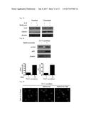 COMPOSITION USING METFORMIN FOR PREVENTING OR TREATING IMMUNE DISEASES     INCLUDING LUPUS diagram and image