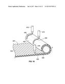 FILTER MEDIA AND FILTER ELEMENT WITH ADHESIVE REINFORCING diagram and image