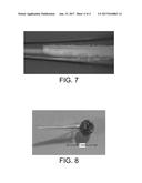 Neurotrophic Electrode System diagram and image