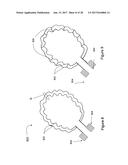 ELECTRONICS FOR DETECTION OF A CONDITION OF TISSUE diagram and image