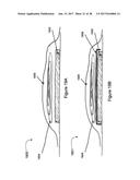 ELECTRONICS FOR DETECTION OF A CONDITION OF TISSUE diagram and image