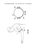 ELECTRONICS FOR DETECTION OF A CONDITION OF TISSUE diagram and image