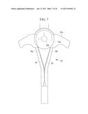 SUTURE INSTRUMENT diagram and image