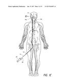 ANEURYSM TREATMENT COILS diagram and image