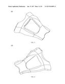 PROXIMAL BUNION RESECTION GUIDES AND PLATES AND METHODS OF USE diagram and image