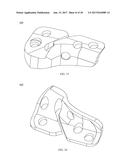 PROXIMAL BUNION RESECTION GUIDES AND PLATES AND METHODS OF USE diagram and image