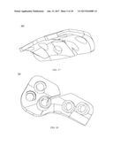 PROXIMAL BUNION RESECTION GUIDES AND PLATES AND METHODS OF USE diagram and image