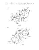 PROXIMAL BUNION RESECTION GUIDES AND PLATES AND METHODS OF USE diagram and image