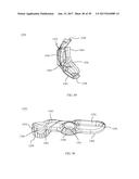 PROXIMAL BUNION RESECTION GUIDES AND PLATES AND METHODS OF USE diagram and image