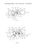 PROXIMAL BUNION RESECTION GUIDES AND PLATES AND METHODS OF USE diagram and image