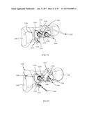 PROXIMAL BUNION RESECTION GUIDES AND PLATES AND METHODS OF USE diagram and image