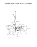 PROXIMAL BUNION RESECTION GUIDES AND PLATES AND METHODS OF USE diagram and image