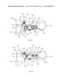 PROXIMAL BUNION RESECTION GUIDES AND PLATES AND METHODS OF USE diagram and image