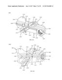 PROXIMAL BUNION RESECTION GUIDES AND PLATES AND METHODS OF USE diagram and image