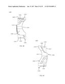 PROXIMAL BUNION RESECTION GUIDES AND PLATES AND METHODS OF USE diagram and image