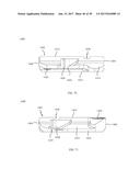 PROXIMAL BUNION RESECTION GUIDES AND PLATES AND METHODS OF USE diagram and image