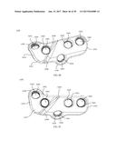 PROXIMAL BUNION RESECTION GUIDES AND PLATES AND METHODS OF USE diagram and image