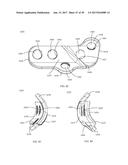 PROXIMAL BUNION RESECTION GUIDES AND PLATES AND METHODS OF USE diagram and image