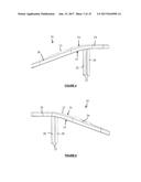 BONE FIXATION DEVICES AND METHODS diagram and image