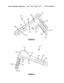 BONE FIXATION DEVICES AND METHODS diagram and image
