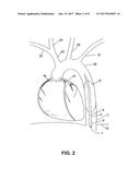 SYSTEMS, DEVICES AND METHODS FOR RESUSCITATION diagram and image