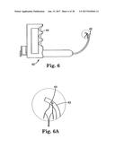 SURGICAL ARTICLES AND METHODS diagram and image