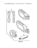 SURGICAL ARTICLES AND METHODS diagram and image