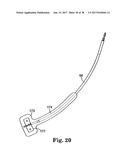 SURGICAL ARTICLES AND METHODS diagram and image