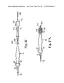 SURGICAL ARTICLES AND METHODS diagram and image