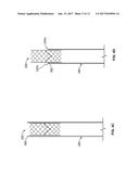 MITRAL VALVE REPLACEMENT TOGGLE CELL SECUREMENT diagram and image